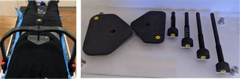 Compression Plate Fixation 的图像结果