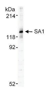 Goat anti-SA1 Antibody, Affinity Purified Powered by Bethyl ...