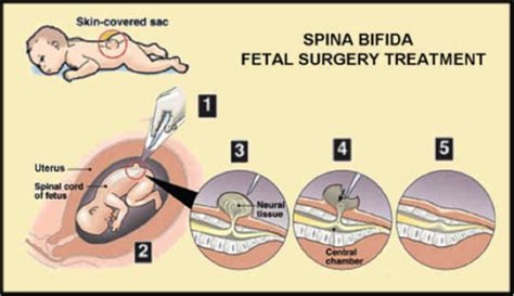 Image result for Biometry Ob