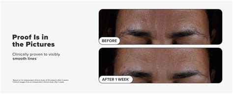 PAULA'S CHOICE SKIN PERFECTING 2% BHA Liquid Salicylic Acid Exfoliant ...