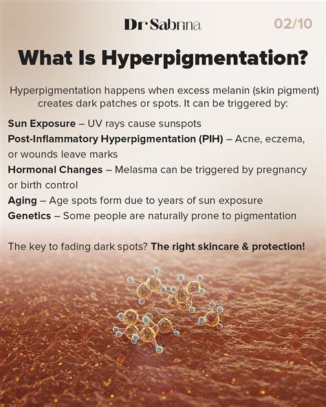 What Is Hyperpigmentation? Causes & Solutions in 2025 | Treating hyperpigmentation ...