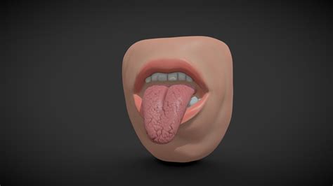 Down Syndrome Tongue