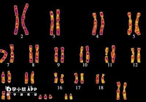 13号染色体部分缺失孩子能不能要？有这些异常影响大 - 久久助孕网