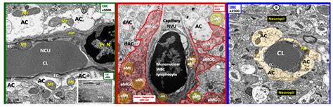 Hypothesis: Astrocyte Foot Processes Detachment from the Neurovascular ...