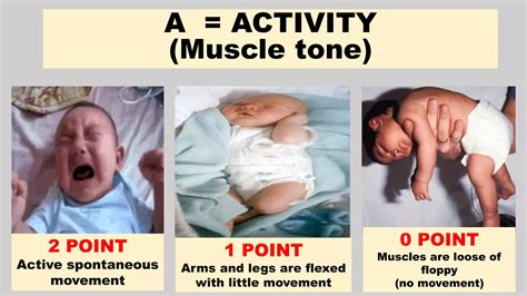 Apgar score |newborn assessment | PPTX