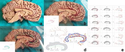 Cingulate Gyrus Function 的图像结果