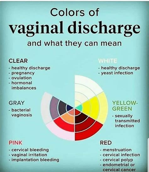 What Is Yellow Discharge From Breast at Adelina Simmons blog