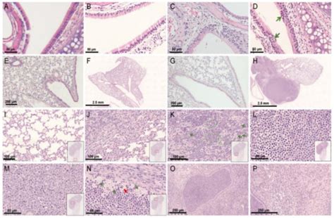 Viruses | Special Issue : Respiratory Syncytial Virus 2.0