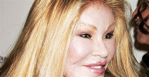 Plastic Surgery Disasters 的图像结果