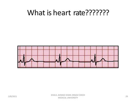 Basic of ECG with common abnormalities. | PPTX