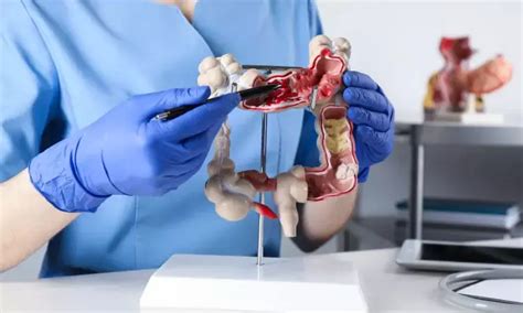 SPONGE assisted Laparoscopic or robotic surgery of sigmoid colon and ...