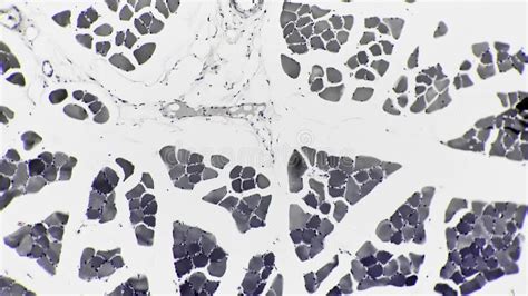 Image result for Skeletal Muscle Tissue Under Microscope