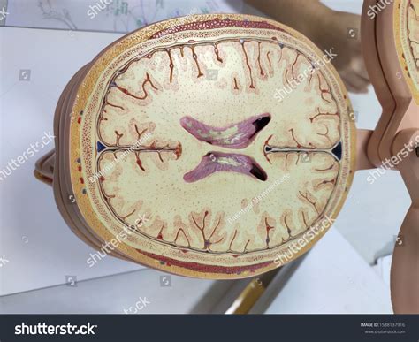 Image result for Brain Tissue Sample