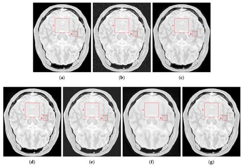 Non-Local SVD Denoising of MRI Based on Sparse Representations