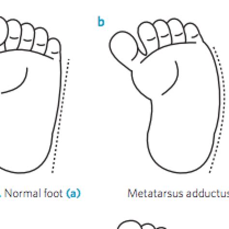 Paediatric Othopaedics | Surgeons | Sports Medicine | Ballarat OSM