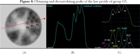 Image result for Spatial Resolution Pet
