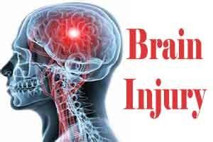 CT scans offer critical information for concussion patients: JAMA