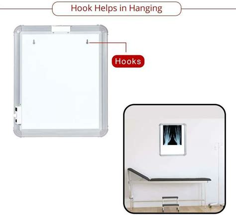 SMIC LED X Ray Illuminator View Box Automatic Film Activation, Variable ...
