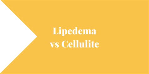 Lipedema vs Cellulite - Lipedema and Me