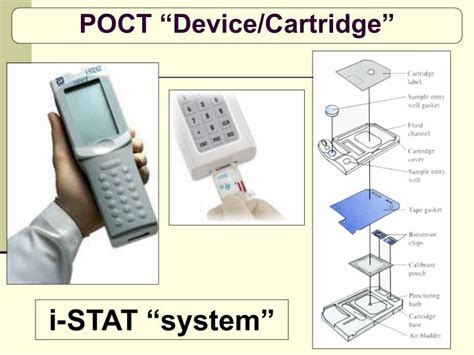 Istat calibration verification procedure - papabezy