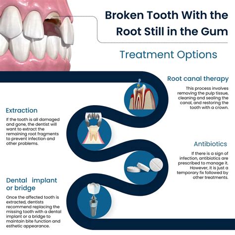 Broken Tooth, Root Still In Gum: What To Do? | Broadway Family Dental
