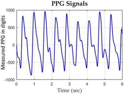 Machine Learning Classification for Assessing the Degree of Stenosis ...