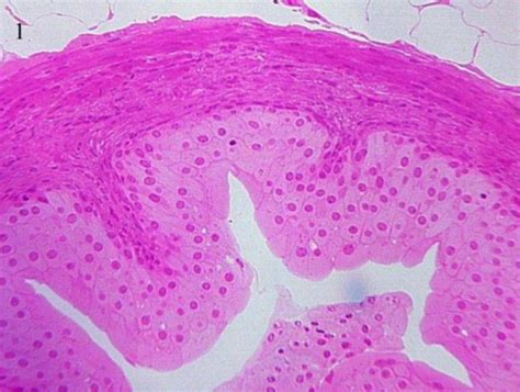 Image result for Ephilehal Tissue Sample