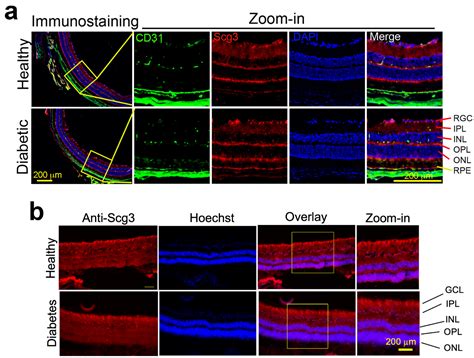 Secretogranin III Selectively Promotes Vascular Leakage in the Deep ...