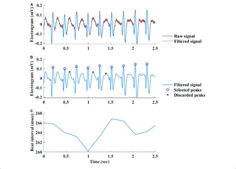 Image result for Beat Detection Algorithm