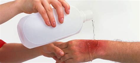 Siddharth Hospital- Best Multispeciality |orthopedic,Trauma care ...