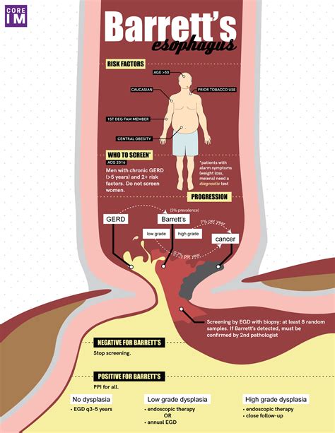 Barrett's Esophagus Cough Treatment at Tracy Dibenedetto blog