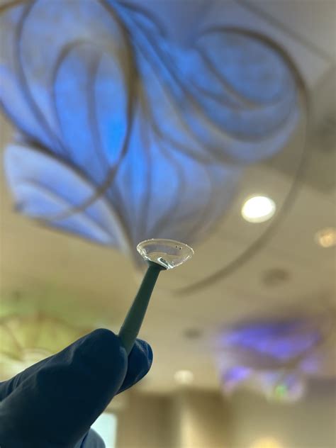 Dot on Scleral Lens: What Does it Mean? - ReVision Optometry