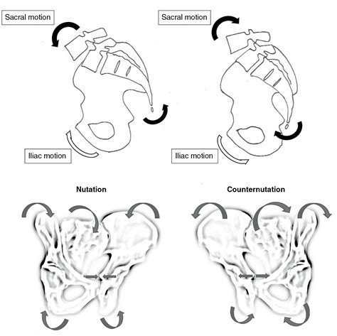 Disorders of the sacroiliac joint - Clinical Tree