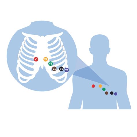 Mastering 12 Lead ECG Placement: An Expert Guide