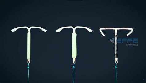 Best 3D Intrauterine Devices Animation Video for Education