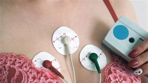 World's First Leadless Pacemaker: Woman With Complex Congenital Heart ...