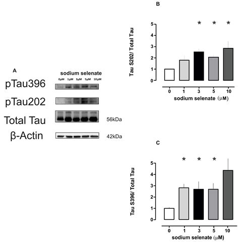 The Anti-Tumor Agent Sodium Selenate Decreases Methylated PP2A ...
