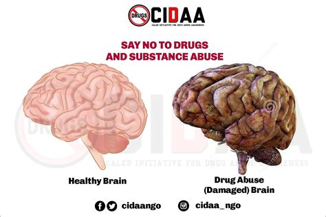Damaged Brain From Drugs