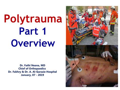 Polytrauma part 1 (overview) | PPT