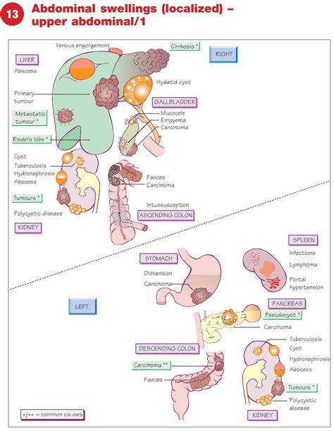 Upper Abdominal Swelling - Causes, Clinical Signs & Diagnosis