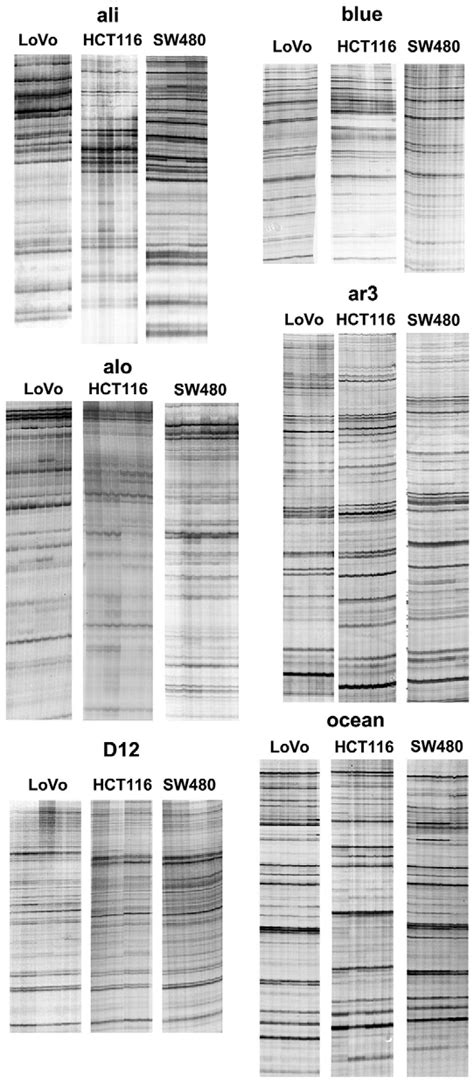 DNA Fingerprinting Examples 的图像结果