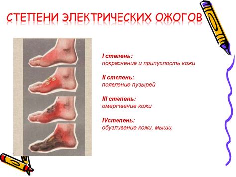 Электротравма. Первая помощь при поражении электрическим током - online ...