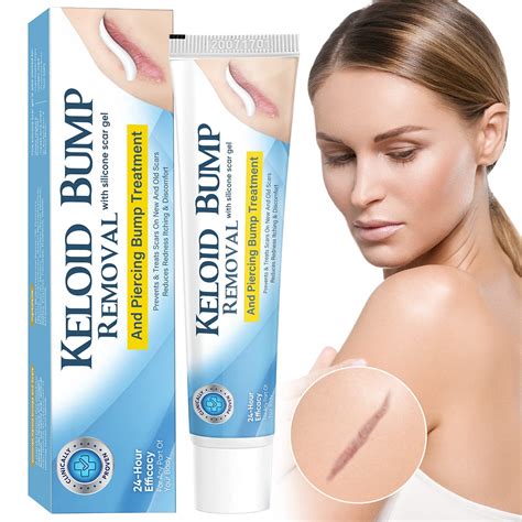 Keloid Ear Keloid Scars Treatment Glasgow | Keloid Scars Removal