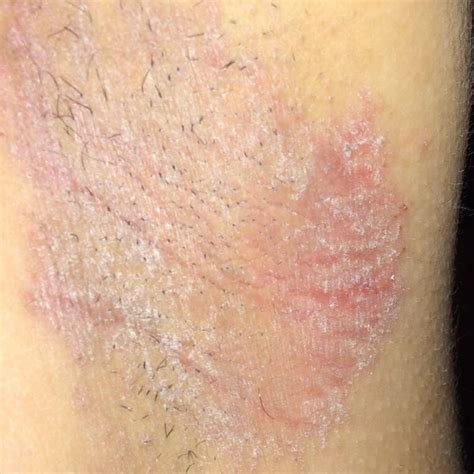 Bildergebnis für effloreszenz