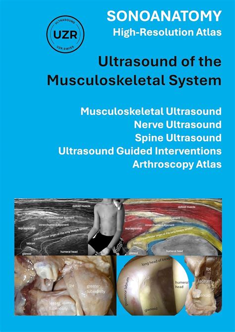 Sonoanatomy - High-Resolution Atlas - Ultrasound of the Musculoskeletal System: Musculoskeletal ...