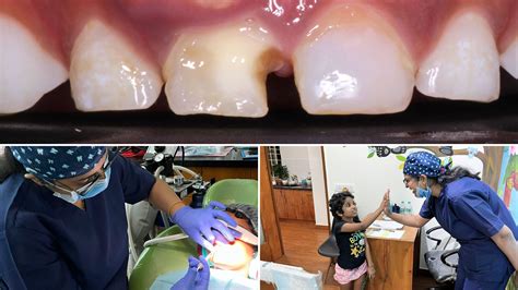 Smile Unleashed: Painless Tooth Extraction with the Magic of Laughing ...