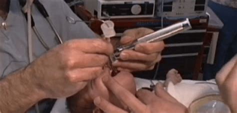 Image result for Difficult Intubation Face