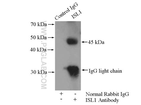 Islet 1 antibody (15661-1-AP) | Proteintech