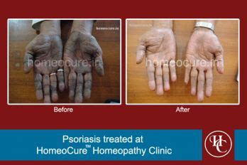 HomeoCure® Homeopathy Clinic, Pune