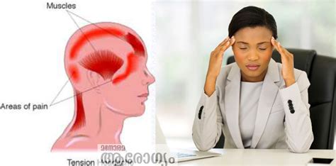 നെറ്റിക്ക് ബാൻഡിട്ട് മുറുക്കിയ പോലെ വേദന; തലയ്ക്കു പിന്നിലും വേദന: ടെൻഷ ...